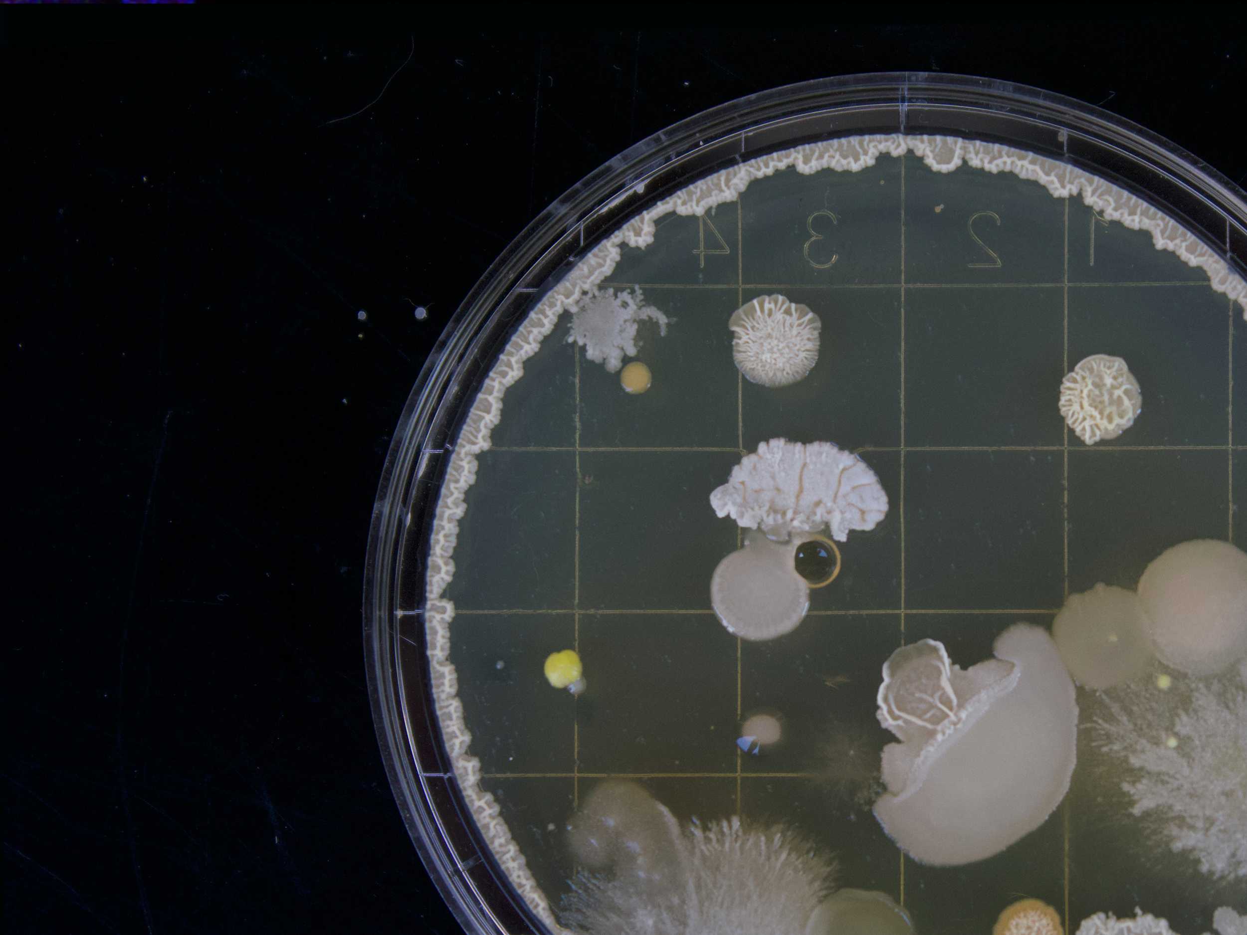 Bacteria sample