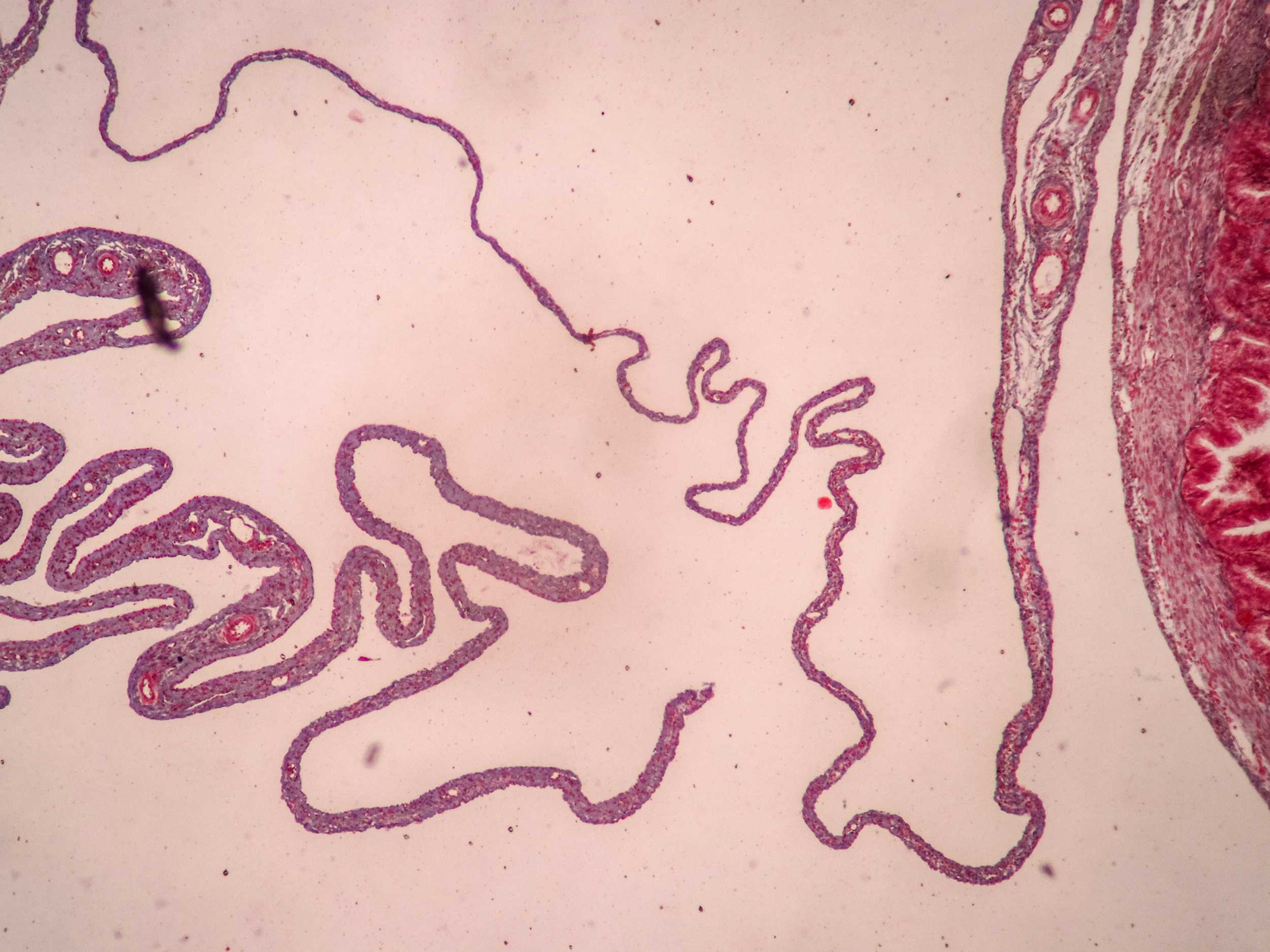 Placenta and umbilical cord under a microscope