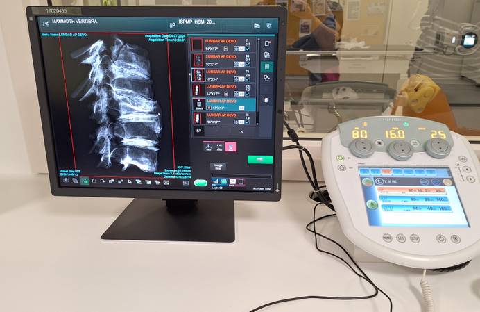 Radiography machine showing mammoth vertebrae