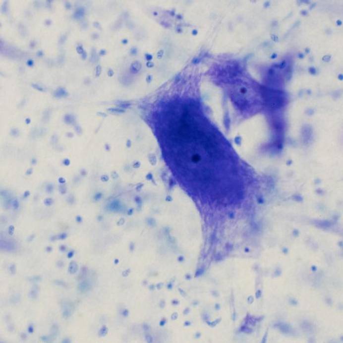 Neurons in the brain under a microscope