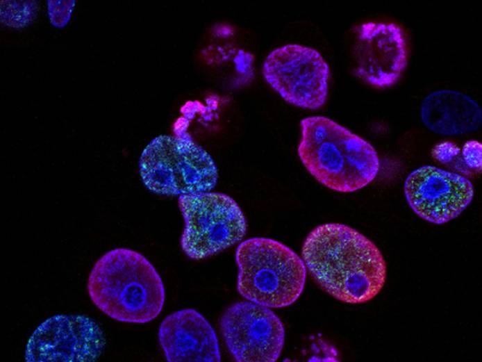 Cells under a microscope
