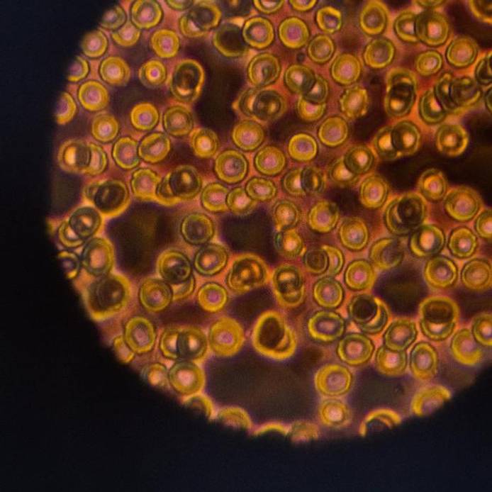 Microscope showing blood cells