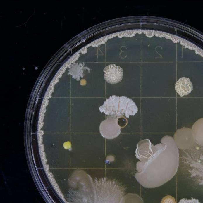 Bacteria sample