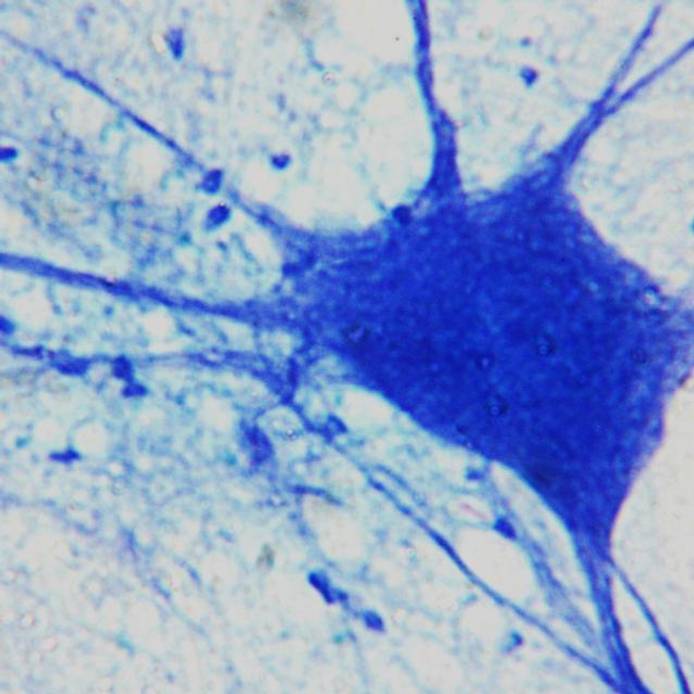 Neuron cell in the brain under a microscope