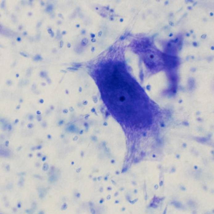 Neurons in the brain under a microscope