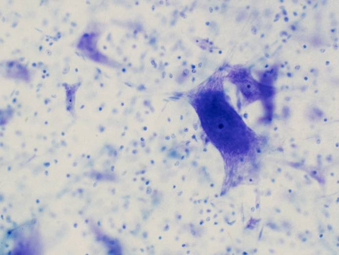 Neurons in the brain under a microscope