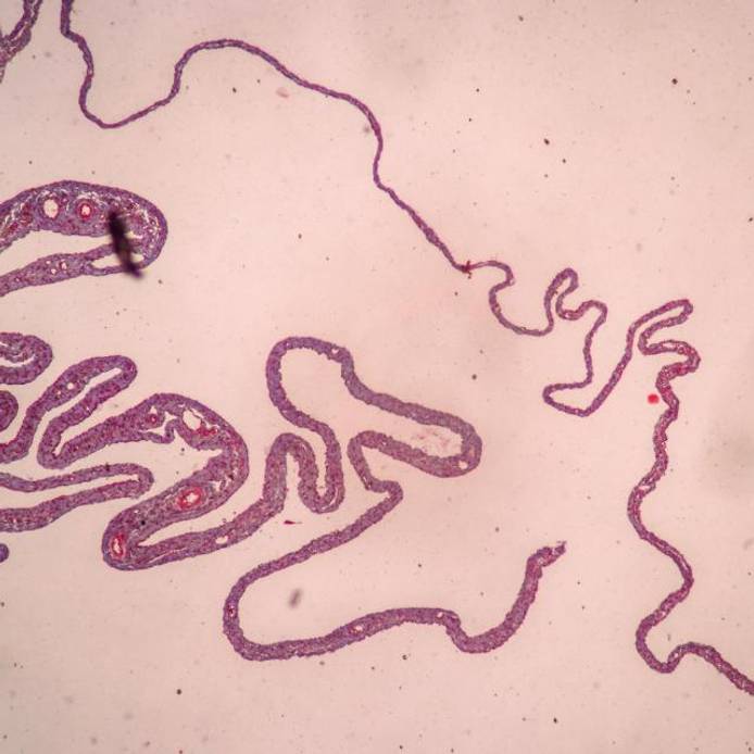 Placenta and umbilical cord under a microscope