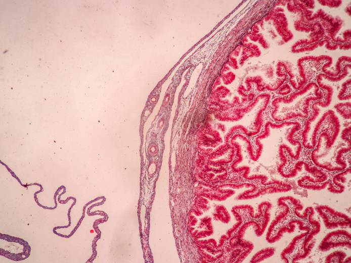 Placenta and umbilical cord under a microscope