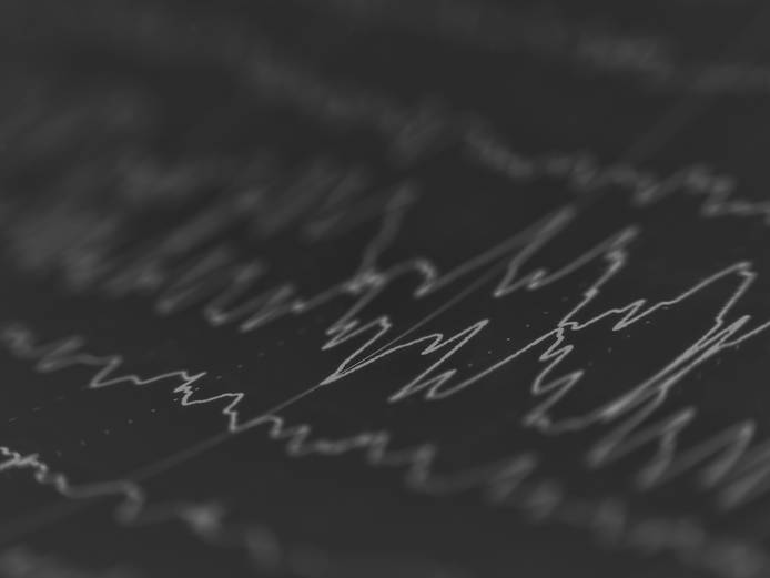 EEG waves