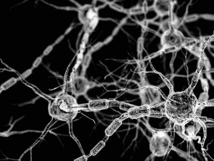 Neural network