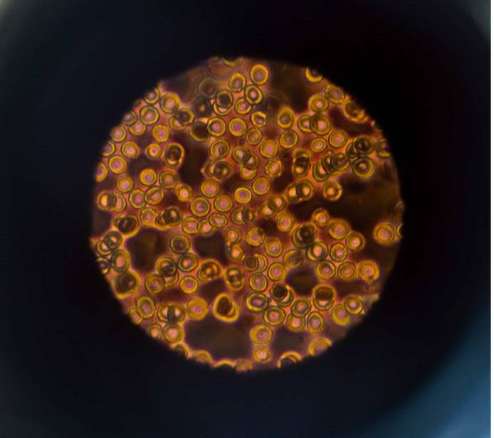 under-microscope