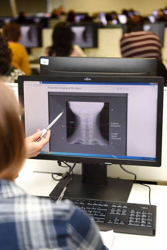 A student looking a x-ray on a computer screen